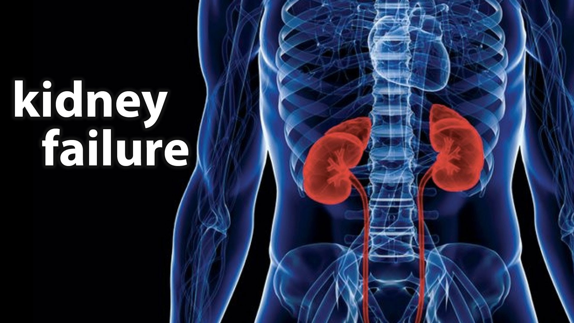 types-of-kidney-failure-united-dialysis-center